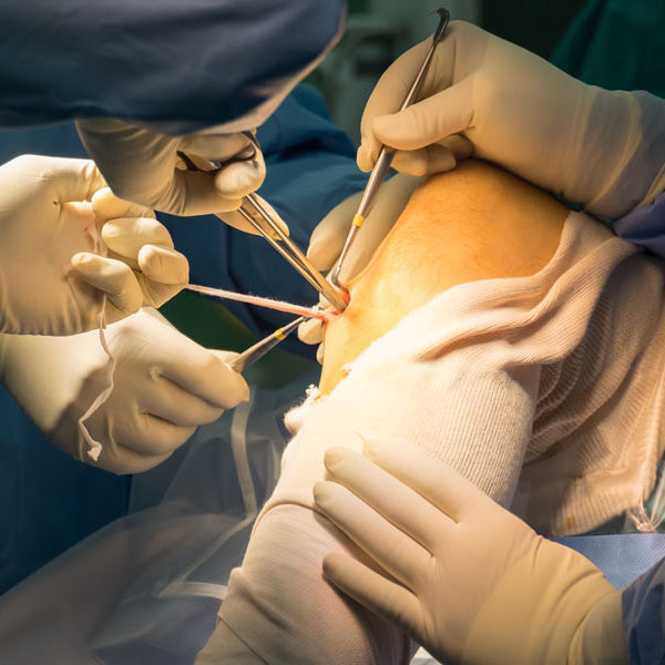 endoscopia