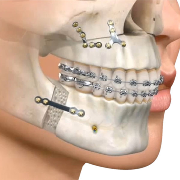 cirugiamaxilofacial1